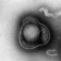 Electronmicrograph of Herpesvirus