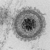 Electronmicrograph of Herpesvirus specially treated